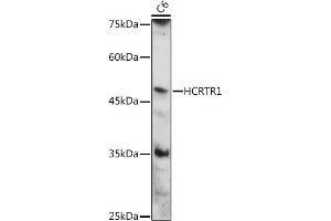 Western blot analysis of extracts of C6 cells, using HCRTR1 antibody (ABIN7267816) at 1:1000 dilution. (HCRTR1 anticorps  (AA 150-250))