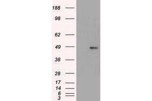 Western Blotting (WB) image for anti-Forkhead Box A1 (FOXA1) (AA 1-473) antibody (ABIN1490773) (FOXA1 anticorps  (AA 1-473))