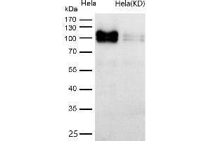 All lanes use the Antibody at 1:1K dilution for 1 hour at room temperature.