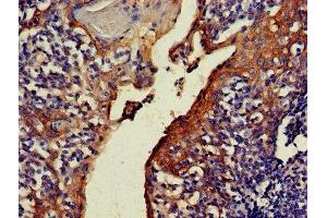 IHC image of ABIN7161631 diluted at 1:500 and staining in paraffin-embedded human tonsil tissue performed on a Leica BondTM system.