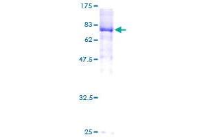 Image no. 1 for V-Yes-1 Yamaguchi Sarcoma Viral Oncogene Homolog 1 (YES1) (AA 1-543) protein (GST tag) (ABIN1325511)
