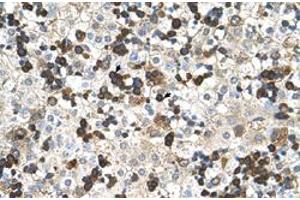 Immunohistochemical staining (Formalin-fixed paraffin-embedded sections) of human liver with HBZ polyclonal antibody  at 4-8 ug/mL working concentration. (HBZ anticorps  (N-Term))