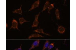 Immunofluorescence analysis of L929 cells using SCGN Polyclonal Antibody at dilution of 1:100.