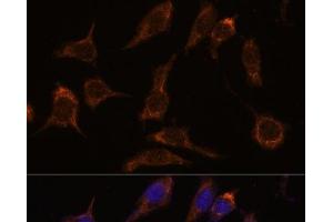 Immunofluorescence analysis of L929 cells using SCGN Polyclonal Antibody at dilution of 1:100. (SCGN anticorps)