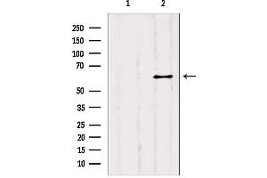 Western blot analysis of extracts from B6F10, using YTHDF2 antibody. (YTHDF2 anticorps  (Internal Region))