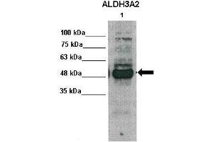 WB Suggested Anti-ALDH3A2 Antibody    Positive Control:  Lane1: 30ug human primary hepatocytes   Primary Antibody Dilution :   1:1000  Secondary Antibody :   Anti-rabbit-HRP   Secondry Antibody Dilution :   1:5000  Submitted by:  Takeshi Saito, USC Keck School of Medicine (ALDH3A2 anticorps  (Middle Region))