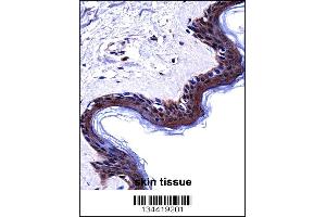 DSG1 Antibody immunohistochemistry analysis in formalin fixed and paraffin embedded human skin tissue followed by peroxidase conjugation of the secondary antibody and DAB staining.