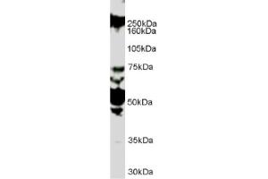 Image no. 1 for anti-Roundabout, Axon Guidance Receptor, Homolog 1 (ROBO1) (Internal Region) antibody (ABIN374636) (ROBO1 anticorps  (Internal Region))