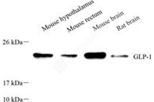 Western blot analysis of GLP1 (ABIN7074052),at dilution of 1: 800 (GLP-1 anticorps)