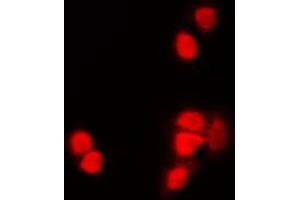 Immunofluorescent analysis of Histone H3 (AcK9) staining in NIH3T3 cells.