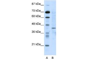 WB Suggested Anti-RING1 Antibody Titration:  5. (RING1 anticorps  (N-Term))
