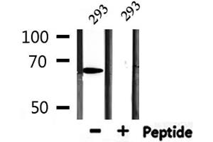 Western blot analysis of extracts from 293, using PIAS2 Antibody. (PIAS2 anticorps)