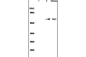 anti-Sirtuin 1 (SIRT1) (AA 101-200) antibody