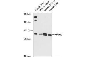 Western blot analysis of extracts of various cell lines using MRPS2 Polyclonal Antibody at dilution of 1:3000. (MRPS2 anticorps)
