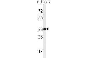 TMBIM4 Antibody (N-term) western blot analysis in mouse heart tissue lysates (35 µg/lane).