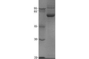 Validation with Western Blot (SEMA3C Protein (His tag))