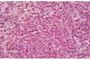 Image no. 2 for anti-14-3-3 zeta (YWHAZ) (AA 200-245) antibody (ABIN1491173)