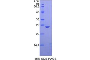 SDS-PAGE of Protein Standard from the Kit (Highly purified E.