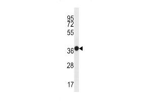 Western blot analysis in WiDr cell line lysates (35ug/lane). (MUC15 anticorps  (C-Term))
