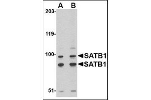 Western blot analysis of SATB1 in A20 cell lysate with this product at (A) 2 and (B) 4 μg/ml. (SATB1 anticorps  (C-Term))