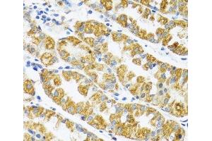 Immunohistochemistry of paraffin-embedded Human stomach using POLG2 Polyclonal Antibody at dilution of 1:100 (40x lens). (POLG2 anticorps)