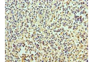 Immunohistochemistry of paraffin-embedded human spleen tissue using ABIN7167113 at dilution of 1:100 (RICTOR anticorps  (AA 1-245))