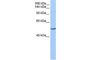 WB Suggested Anti-LAntibody Titration:  0. (LARP1 anticorps  (N-Term))
