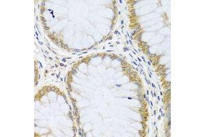 Immunohistochemistry of paraffin-embedded human colon using ARL6 antibody. (ARL6 anticorps  (AA 1-186))