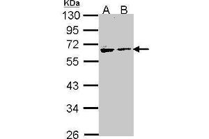 WB Image Sample (30 ug of whole cell lysate) A: H1299 B: Hela 10% SDS PAGE antibody diluted at 1:1000 (Arylsulfatase A anticorps)