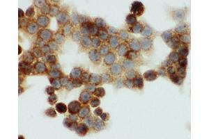 Anti-HNF6 antibody, ICC ICC: HCT116 Cell (ONECUT1 anticorps  (N-Term))