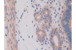 Detection of HEXb in Mouse Uterus Tissue using Polyclonal Antibody to Hexosaminidase B Beta (HEXb) (HEXB anticorps  (AA 294-435))