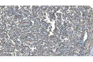 IHC analysis of DRP1/DNM1L using anti-DRP1/DNM1L antibody (ABIN7602180). (Dynamin 1-Like anticorps  (AA 618-736))