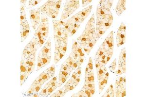 Immunohistochemistry analysis of paraffin-embedded rat muscle using,MYH7 (ABIN7075623) at dilution of 1: 1000 (Slow Skeletal Myosin Heavy Chain anticorps)