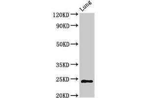 Western Blot Positive WB detected in: Rat lung tissue All lanes: CHMP6 antibody at 3 μg/mL Secondary Goat polyclonal to rabbit IgG at 1/50000 dilution Predicted band size: 24 kDa Observed band size: 24 kDa (CHMP6 anticorps  (AA 2-201))