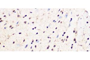Immunohistochemistry of paraffin-embedded Mouse spinal cord using PCIF1 Polyclonal Antibody at dilution of 1:100 40x lens). (PCIF1 anticorps)