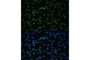 Immunofluorescence analysis of C6 cells using U/U/DDX39B Polyclonal Antibody (ABIN6132226, ABIN6139492, ABIN6139493 and ABIN6224384) at dilution of 1:100 (40x lens).