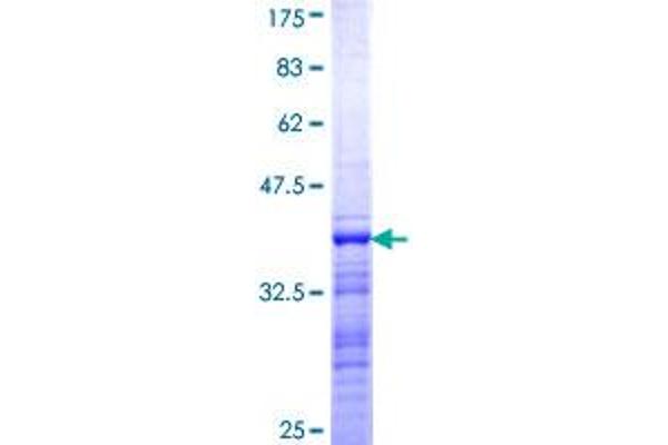 TAF2 Protein (AA 504-603) (GST tag)