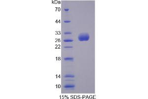 Image no. 1 for UL16 Binding Protein 2 (ULBP2) (AA 2-246) protein (His tag) (ABIN3209971)