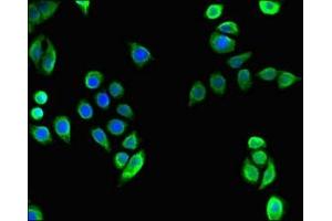Immunofluorescent analysis of PC-3 cells using ABIN7171684 at dilution of 1:100 and Alexa Fluor 488-congugated AffiniPure Goat Anti-Rabbit IgG(H+L) (TECPR2 anticorps  (AA 516-783))