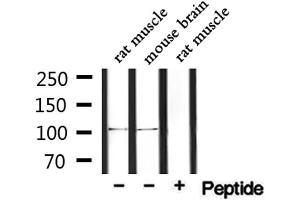 Western blot analysis of extracts from rat muscle and mouse brain, using PDE2A Antibody. (PDE2A anticorps  (C-Term))