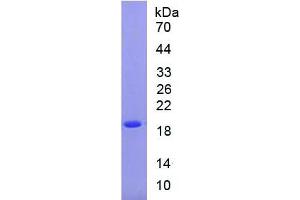 SDS-PAGE of Protein Standard from the Kit (Highly purified E. (SOD1 Kit ELISA)