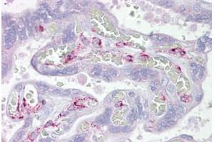 Anti-ING3 antibody IHC staining of human placenta. (ING3 anticorps  (AA 36-85))