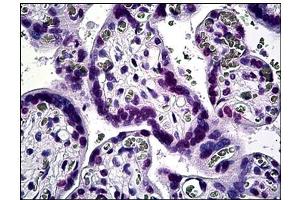Immunohistochemistry (IHC) image for anti-Kruppel-Like Factor 11 (KLF11) antibody (ABIN781889)