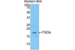 Detection of recombinant GAD1 using Polyclonal Antibody to Glutamate Decarboxylase 1, Brain (GAD1) (GAD anticorps  (AA 1-97))