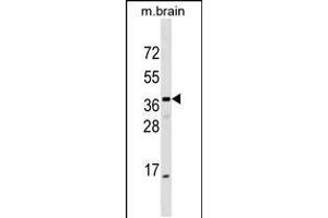 Western blot analysis in mouse brain tissue lysates (35ug/lane). (ELMOD1 anticorps  (AA 106-135))