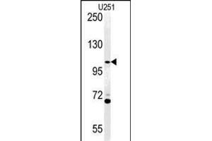 Western blot analysis of AC Antibody (N-term) (ABIN651370 and ABIN2840207) in  cell line lysates (35 μg/lane). (Acap3 anticorps  (N-Term))