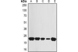 Western blot analysis of KNP-I expression in SW480 (A), HepG2 (B), mouse skin (C), mouse heart (D), rat skeletal muscle (E) whole cell lysates. (KNP-1 anticorps)