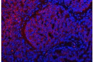 IF analysis of TRMT2B using anti-TRMT2B antibody (ABIN7599456). (TRMT2B anticorps  (AA 1-504))