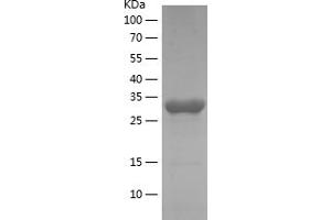 Western Blotting (WB) image for 3-phosphoinositide Dependent Protein Kinase-1 (PDPK1) (AA 92-151) protein (His-IF2DI Tag) (ABIN7121616)