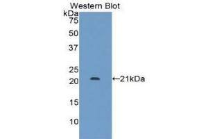 Western blot analysis of the recombinant protein. (LIFR anticorps  (AA 522-691))
